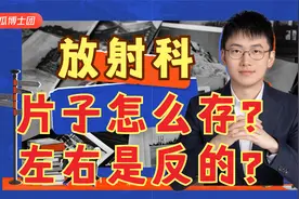 放射科胶片该如何保存？为什么报告里左右跟片子里是反的？答疑视频封面