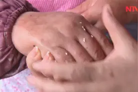 大姐每天贴烧饼，一天能贴300余个，双手整日红肿被称“烧饼手”视频封面