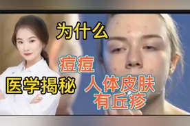 医学揭秘 丘疹是什么 为什么有些人皮肤长痘痘和青春痘 如何演变