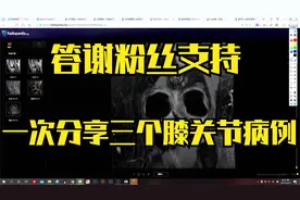 粉丝强烈要求的膝关节磁共振诊断，安排！一期三病例，吃到饱！视频封面