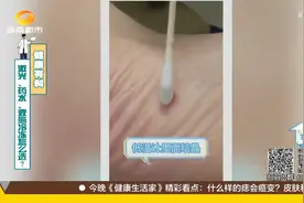 激光、药水、液氮冷冻三种点痣方法，怎么选择？专家意见来了视频封面