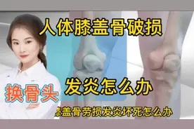 医学演绎人体膝盖骨破损坏死怎么办置假骨头 医生手术操作视频封面