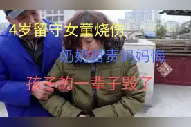 4岁留守儿童烧伤，奶奶自责妈妈悔，孩子的一辈子毁了。视频封面