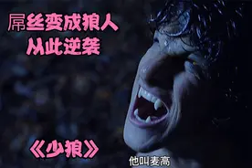 小伙半夜在森林闲逛，被大灰狼袭击，事后身体开始变异变成狼人视频封面