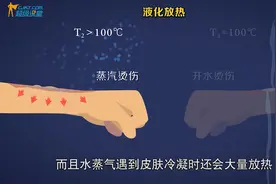 蒸汽烫伤侮辱性不强，但伤害性极强的一种受伤方式