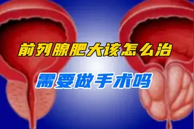 前列腺肥大该怎么治，需要做手术吗