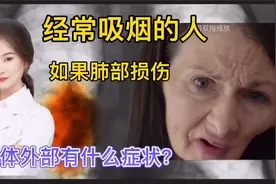 经常吸烟或者受环境污染 如果肺部受到损害 身体有哪些临床表现？视频封面