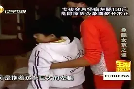 王刚讲故事：象腿女孩跨越上千公里求医，临出发前亲朋围了一圈视频封面