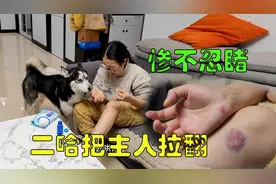 女子遛二哈结果被摔了个狗啃泥，主人摔倒后二哈继续拖尸，太惨了