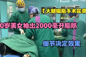 「大腿吸脂手术实录」30岁美女抽出2000毫升脂肪，细节决定效果视频封面