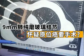 查出9mm纯磨玻璃结节，有血管怀疑原位癌，手术还是继续观察？