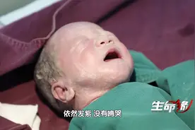 二宝出生没有啼哭，医生迅速抢救，三宝被脐带绕颈一周，情况危急视频封面