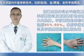 3d全形手指再造成功率怎么样？黄威医生科普视频封面