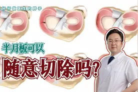 半月板就是块软骨，可以随意切除！医生辟谣，讲清其4大重要作用视频封面