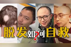 4种脱发类型，有什么办法可以解决？