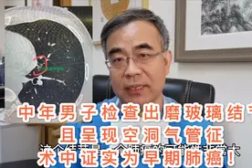 磨玻璃结节中有空洞气管征，是早期肺癌的可能性很大视频封面