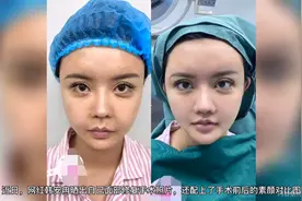 网红韩安冉再整容！嘴唇肿胀下巴尖成锥子，14岁直言活到老整到老视频封面