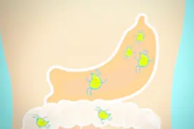 胃癌术后转移复发时间视频封面
