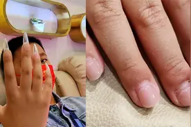 孩子爱啃指甲改不掉，妈妈无奈使出绝招让人傻眼：成功留下黑历史视频封面