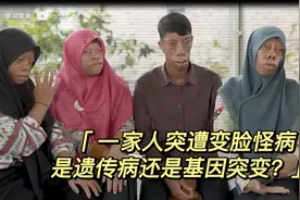 一家人突遭变脸怪病，长相类似原始人，是遗传病还是基因突变？视频封面
