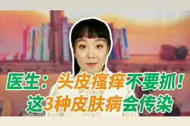 头皮瘙痒不要抓，医生提醒：3种头皮皮肤病会传染视频封面