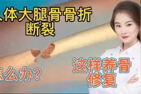 医学演绎 人体大腿骨折骨裂 如何修复  看医生如何实操视频封面