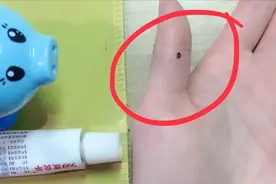 大拇指上长痣的手相，说明父母就是你此生的贵人视频封面