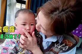 小宝无缘无故满脸红痘痘，整个脸看起来都发肿，季节性过敏要注意视频封面