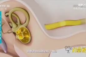 到底什么是人工耳蜗？一段动画演示其工作原理，来看看|健康之路视频封面
