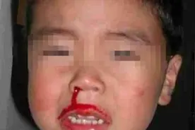3岁女童醒来满脸血，吓坏宝妈，奶奶却这么做视频封面