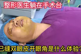 35岁整形医生躺在手术台，自己缝双眼皮是什么体验？眼综合实录视频封面