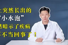 手上突然长出的“小水泡”居然暗示了疾病，别再不当回事了！视频封面