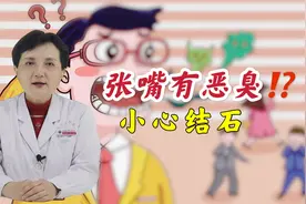 张嘴一股恶臭，可能是扁桃体里的小石头在捣鬼，医生教你除掉