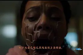 男子突然眼部不适，上手抠眼球，最后竟拉出一条绦虫视频封面