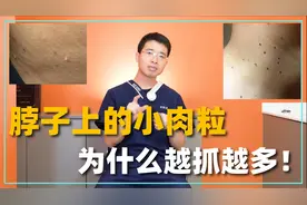 脖子上的小揪揪越抓越多？有可能是感染病毒！医生教你如何解决