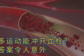 多运动锻炼能把血栓冲开吗？医生：这几件事你得知晓视频封面