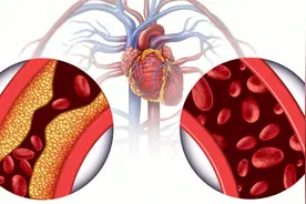 心绞痛发作有濒死感，咋办？别怕，这要做好这4点，立马就能缓解