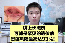 嘴上长黑斑的人要小心，癌症可能已经盯上了你，而且还会遗传！视频封面