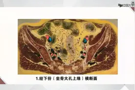 断层影像解剖学--六、盆部--6.4女性盆部与会阴视频封面
