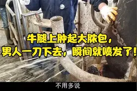 牛腿上肿起大脓包，男人一刀下去，瞬间就喷发了！视频封面