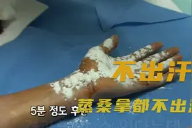 蒸桑拿都不会出汗的大妈，一辈子没出过汗视频封面