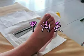 指甲扎肉要及时修剪，不要等到甲沟发炎，疼痛难忍。视频封面