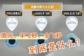 傻傻分不清的准激光、半飞秒、全飞秒到底是什么？视频封面