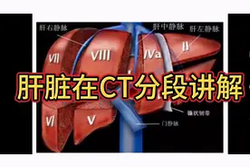 肝脏在CT上 如何分叶和分段？放射科医生教你速记口诀。视频封面