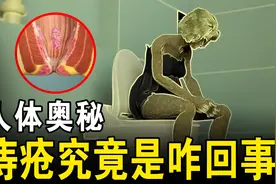 俗话说：“十男九痔，十女十痔”，痔疮究竟是啥？动画带你看明白视频封面