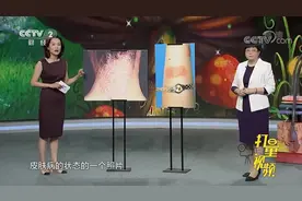 湿疹是什么原因引起的？专家：内因和外因都很重要|职场健康课视频封面