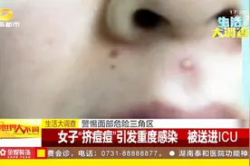 女子“挤痘痘”引发重度感染，医生提醒：警惕面部危险“三角区”视频封面