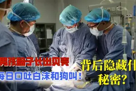 男童脑袋里长出贝壳，口吐白沫和狗吠背后，原来是父母的这个举动视频封面