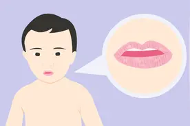 嘴巴周围长红色疹子怎么回事？听听现代医学怎么解释视频封面
