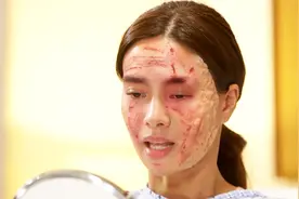 女孩整容失败成麻子脸，却被癖好特殊的富二代看中视频封面
